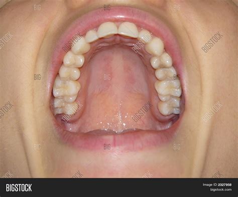 Healthy Teeth Image & Photo | Bigstock