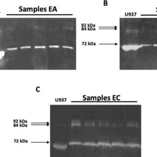 Image result for MMP Pool