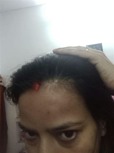 Advanced Hair Growth Serum – OZiva