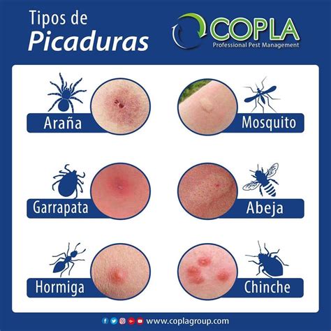 Picadura De Una Hormiga - dobrilo