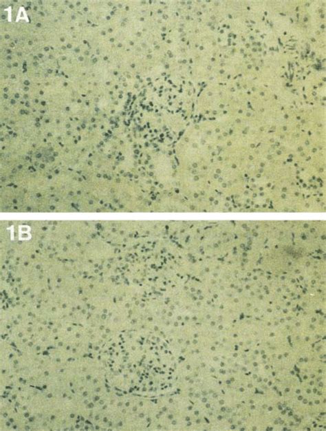Image result for Negative Control for SysV
