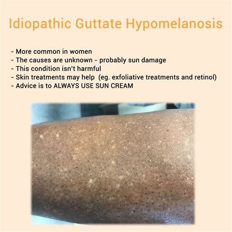 Skin lesions types and treatment – Artofit