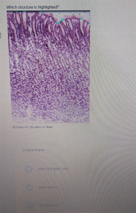 Which Structure Is Highlighted