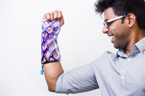 5 Expert-Approved Exercises to Heal A Sprained Wrist Fast