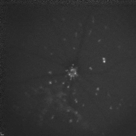 Image result for Detect Image in Image Python-Opencv