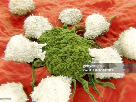 Image result for Lymphocytes Cancer