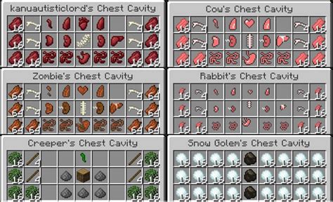 Image result for Minecraft Surgery Mod Gameplay