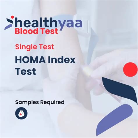 Homa Ir Test