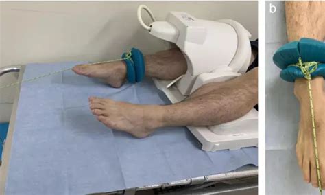 Traction MRI examination useful for evaluating cartilage lesions at the ...