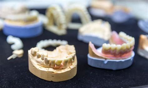 Image result for Different Types Dentures