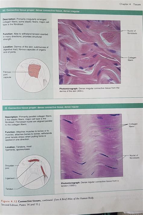 How To Draw Dense Irregular Connective Tissue