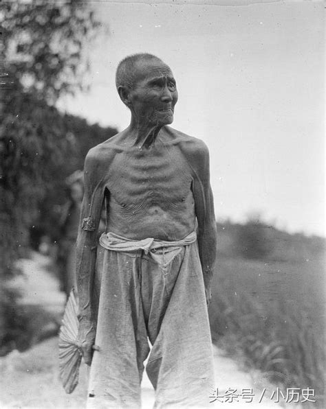 骨瘦如柴的老人骨瘦如柴电影2022已更新今日图集