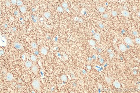 KCC2/SLC12A5-Specific antibody (19565-1-AP) | Proteintech
