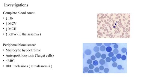 Approach to hypochromic microcytic anemias.pptx