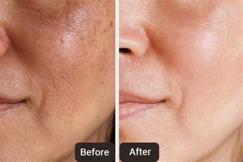 Cosmetic Dermatology Chandigarh | Skinology Plus By Dr. Sheena