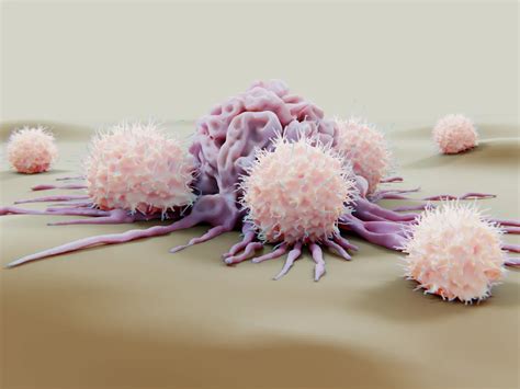 Natural killer cells remember and effectively target ovarian cancer | Karolinska Institutet