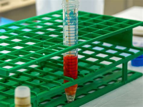 Here's Everything To Know About Rare 'EMM Negative' Blood Group ...