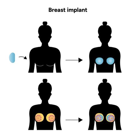 Womens breast anatomy implant medical female diagram | Premium Vector