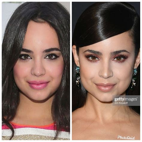 Sofia Carson Face Surgery