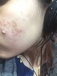 Mamaearth Skin Illuminate Vitamin C Face Serum For Glowing & Radiant ...