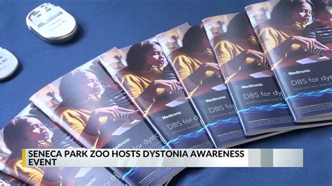 Dystonia Zoo Day raises awareness for movement disorder – RochesterFirst