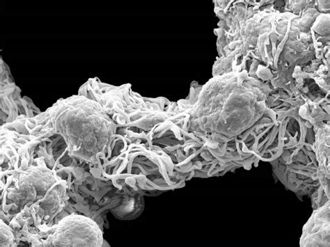 Scanning Electron Microscope Cell 的图像结果