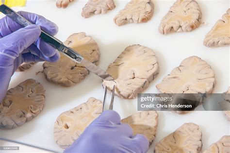 Image result for Brain Tissue Sample