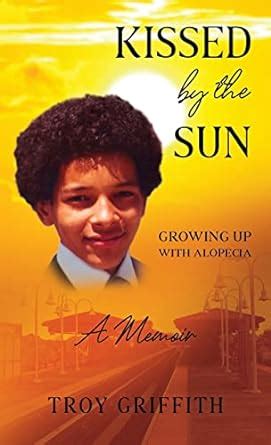 Buy Kissed by the Sun: Growing Up with Alopecia Book Online at Low ...