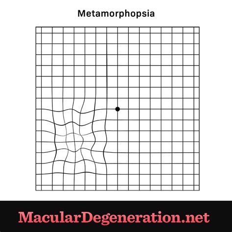 Image result for Distorted Vision Examples
