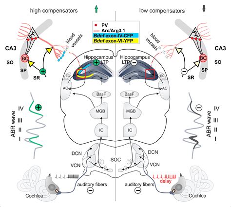 Age-Dependent Auditory Processing Deficits after Cochlear Synaptopathy ...