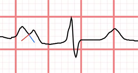 Primary Waves 的图像结果