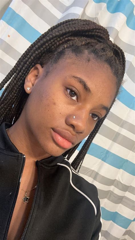 Dark spot remedies : r/Blackskincare