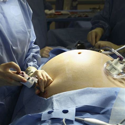 Preoperative Atelectasis and Its Impact on Oxygen Saturation in Obese ...