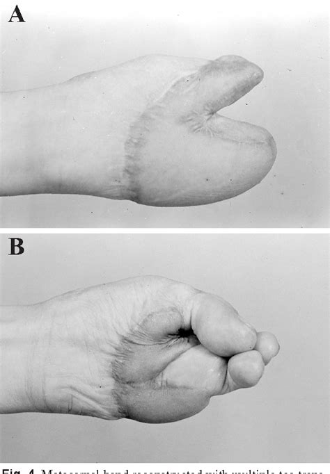 Hand Transplanter 的图像结果