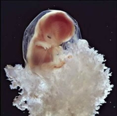 胚胎发育过程图动图_有来医生