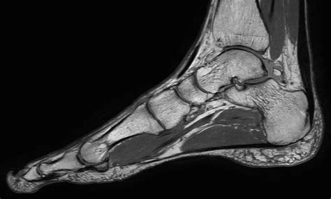 Philips - dStream FootAnkle 16ch coil MR coil