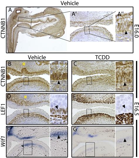IJMS | Special Issue : Mechanisms of Toxicity of Dioxins and Related ...