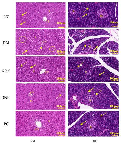 Chemical Constituents and Hypoglycemic Mechanisms of Dendrobium nobile ...