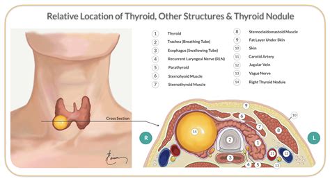 Lump In Throat Thyroid