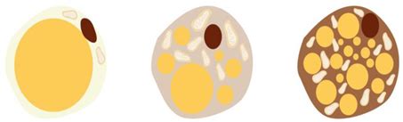 Beyond the Cold: Activating Brown Adipose Tissue as an Approach to ...