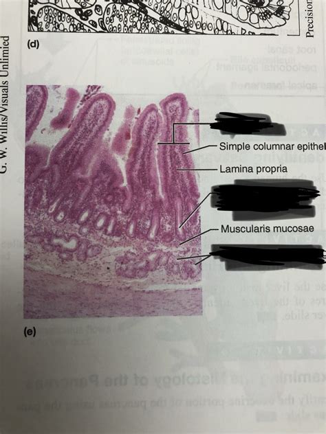 Image result for Duodenum Part