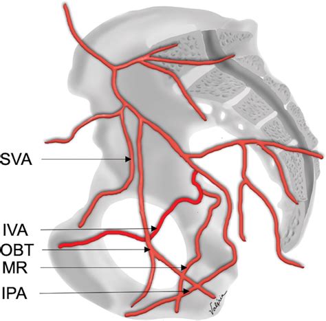 Prostatic Artery Embolization: Indications, Preparation, Techniques ...
