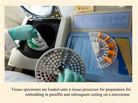 Tissue Processing in Histopathology 的图像结果