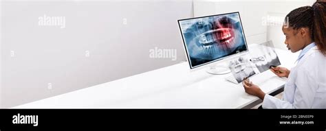 Image result for Dentists Using Computer