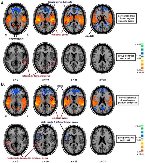 Brain Sciences | September 2013 - Browse Articles