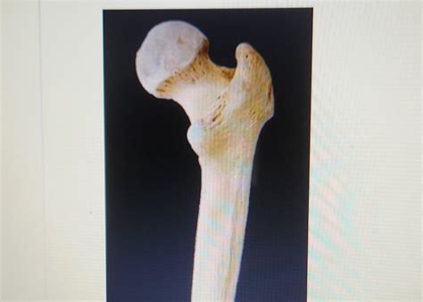 Identify The Highlighted Structure