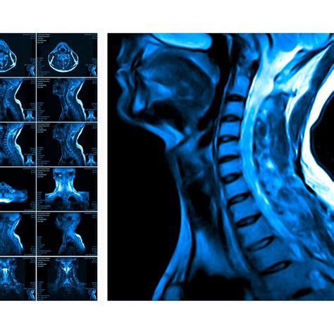 Standards bei Kopf-Hals-Tumoren - HNO - Universimed - Medizin im Fokus