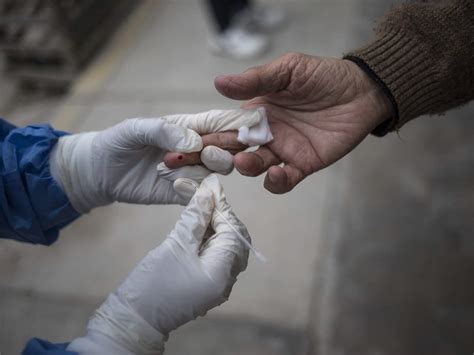 covid symptoms: Backache, abdominal pain, nausea, rashes may also be ...