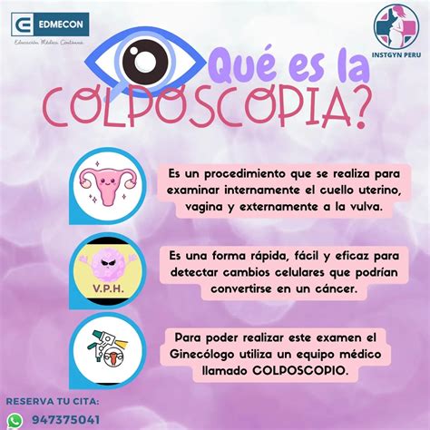 Colposcopia Que Es