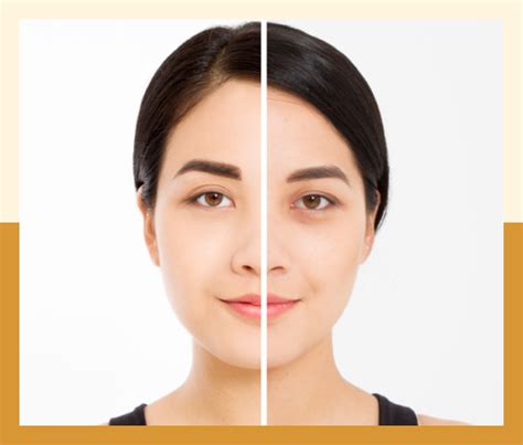 Facial Cosmetic Surgery in Chennai | Dr. Smriti Nathani